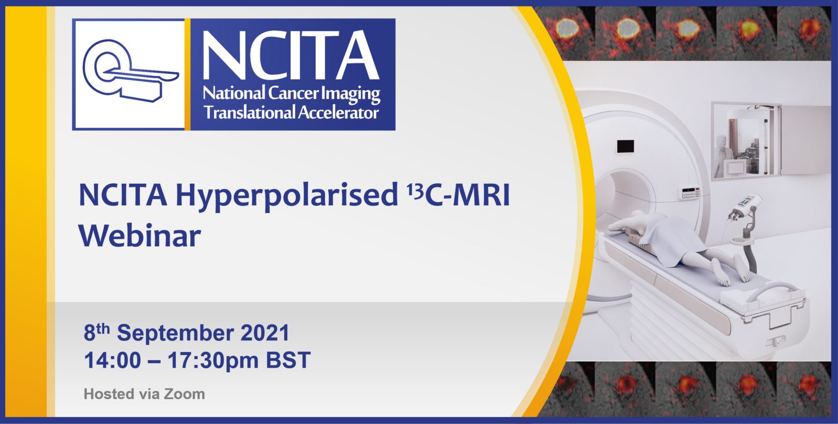 NCITA Hyperpolarised 13C-MRI Webinar