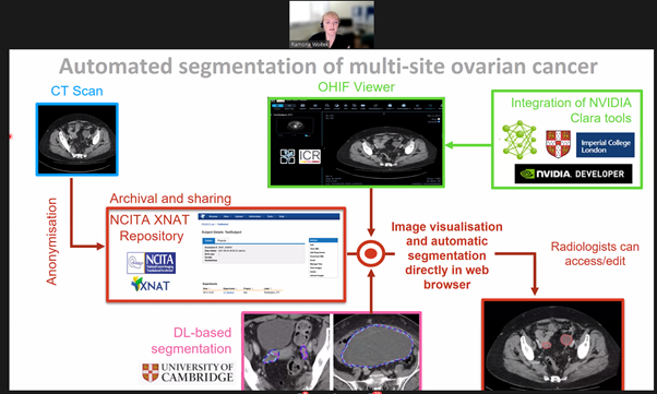 Dr Ramona Woitek presents slide: 'Automated segmentation of multi-site ovarian cancer'