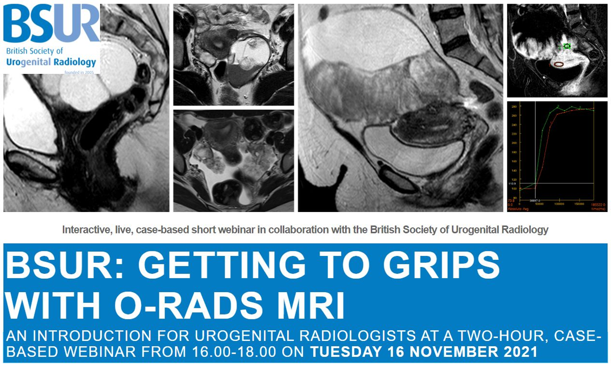 BSUR Getting to grips with O-RADS MRI