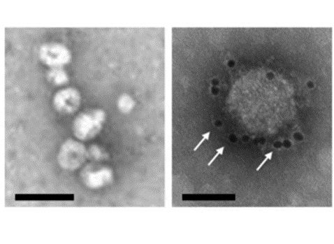 Transmission electron microscopy of exosomes; arrows indicate CD63 immunolabeling. Scale bars, 100 nm (left image) and 50 nm (right image). Monypenny J, Milewicz H, Flores-Borja F, et al. ALIX Regulates Tumor-Mediated Immunosuppression by Controlling EGFR Activity and PD-L1 Presentation. Cell Rep. 2018;24(3):630-641.