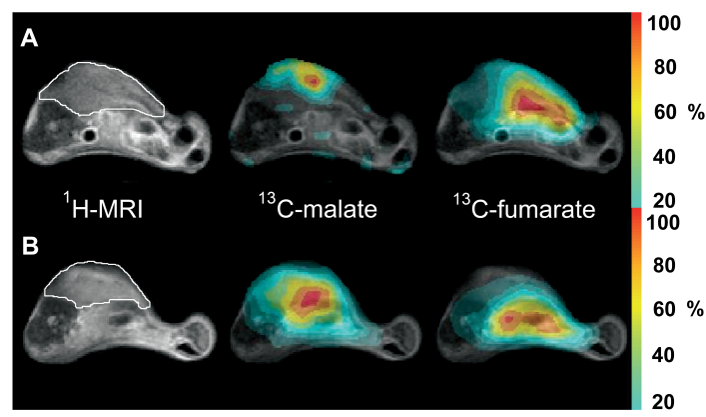 NCITA imaging - Exemplar project 2 image of 1H-MRI, 13C-malate, 13C-fumarate